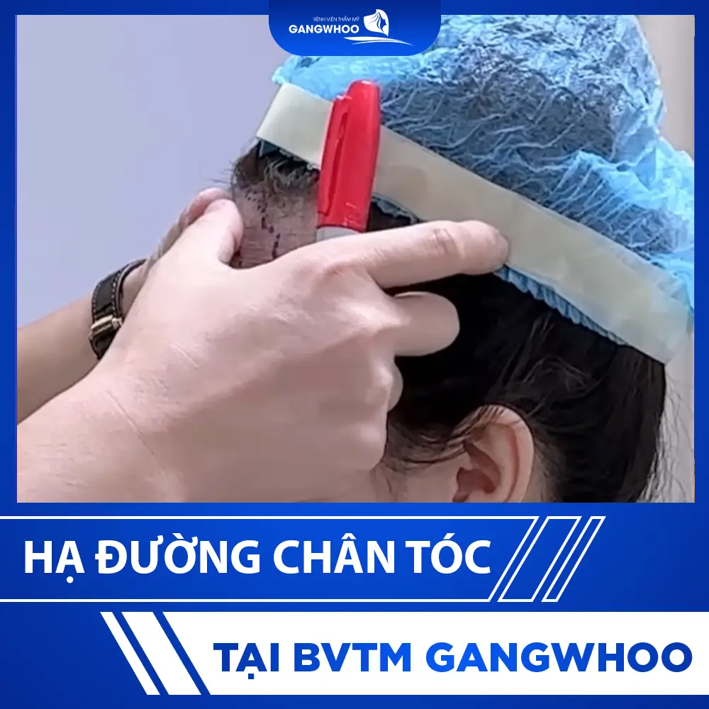 videohaduongchantoc 10