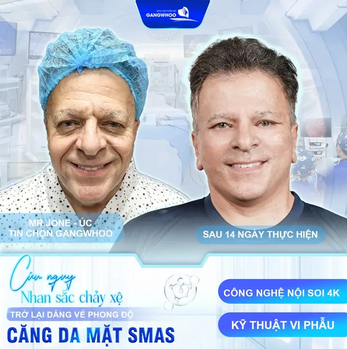 Căng Da Mặt Cho Nam Giải Pháp Cho Gương Mặt Trẻ Trung Phong Độ 16 Căng Da Mặt Cho Nam Giải Pháp Cho Gương Mặt Trẻ Trung Phong Độ