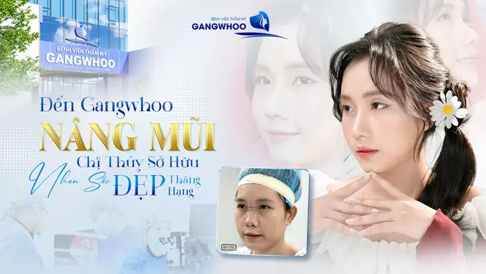 Đến Gangwhoo Nâng Mũi Chị Thủy Sở Hữu Nhan Sắc Đẹp Thăng Hạng 8 Đến Gangwhoo Nâng Mũi Chị Thủy Sở Hữu Nhan Sắc Đẹp Thăng Hạng