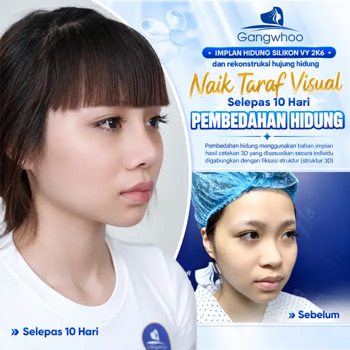 ms nang mui noi soi 4k 14