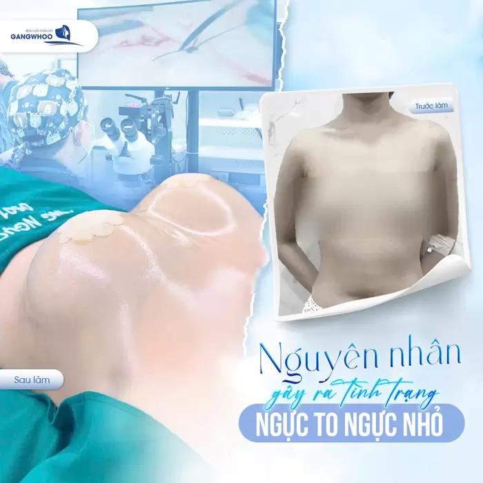 Hiện Tượng Ngực Bên To Bên Nhỏ Là Gì? Cách Khắc Phục Thế Nào
