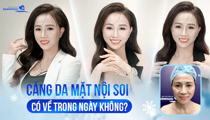 cang da mat noi noi soi co ve trong ngay khong