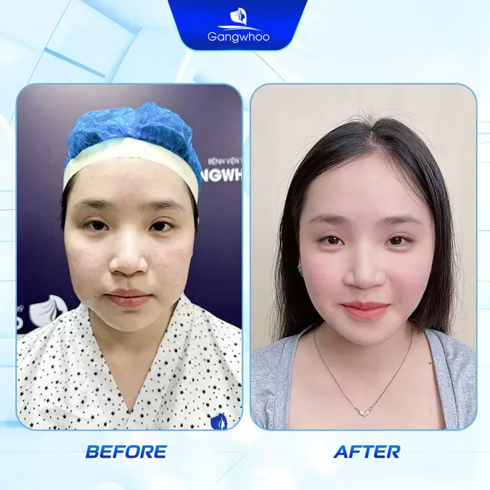 Introduction to Gangwhoo Cosmetic Hospital – A Korean-Standard Hospital 12 en gioi thieu benh vien 2