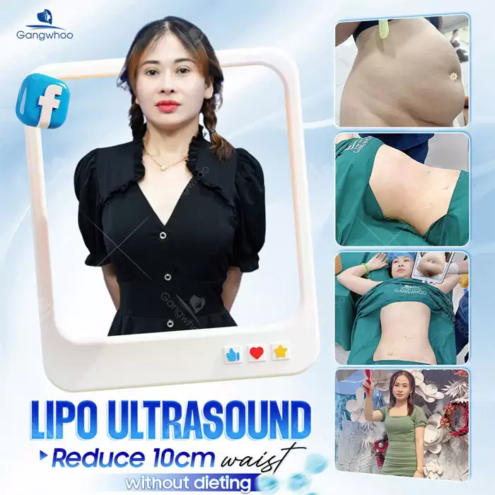 Introduction to Gangwhoo Cosmetic Hospital – A Korean-Standard Hospital 13 en gioi thieu benh vien 7