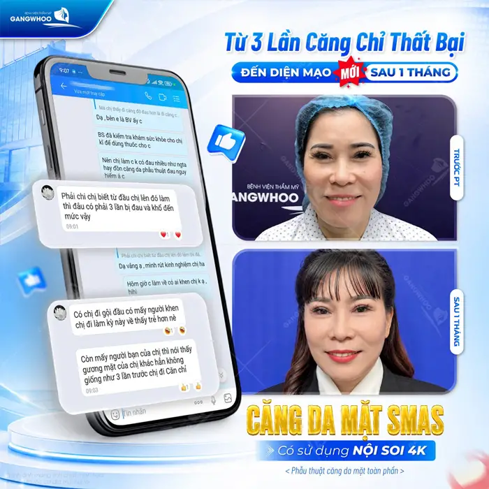 Phẫu Thuật Chỉnh Sửa Các Biến Chứng Sau Mổ Căng Da Mặt Sửa (Căng Da Mặt Hỏng) 14 3 lan cang da mat hong den gangwhoo khoi phuc dien mao va ket qua sau lam qua ung