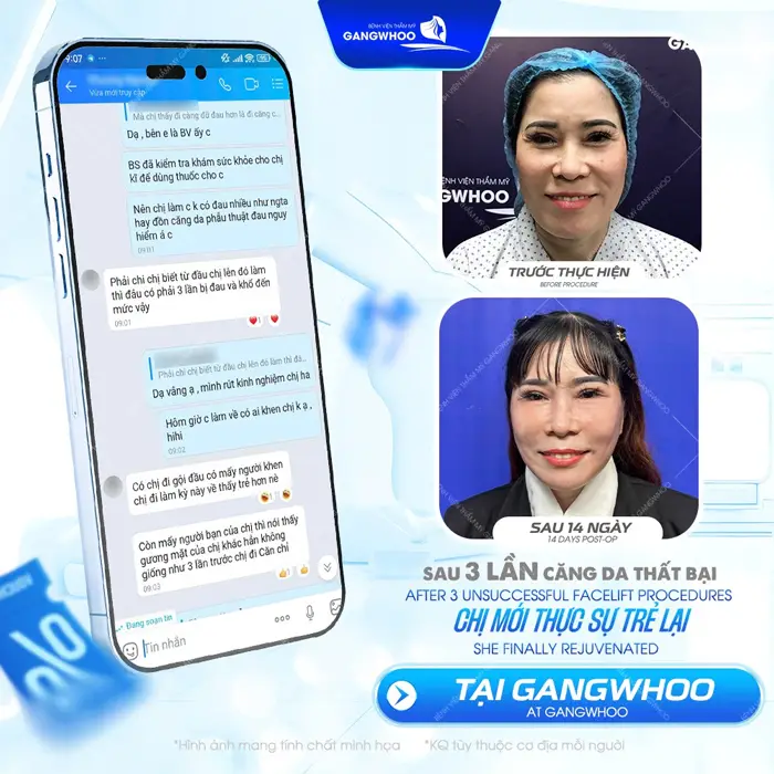 fb sau 3 lan cang da mat that bai tu tin hon voi guong mat tre dep hai hoa