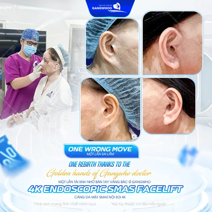 Sửa căng da mặt hỏng với công nghệ hiện đại giải pháp tái sinh diện mạo an toàn và hiệu quả