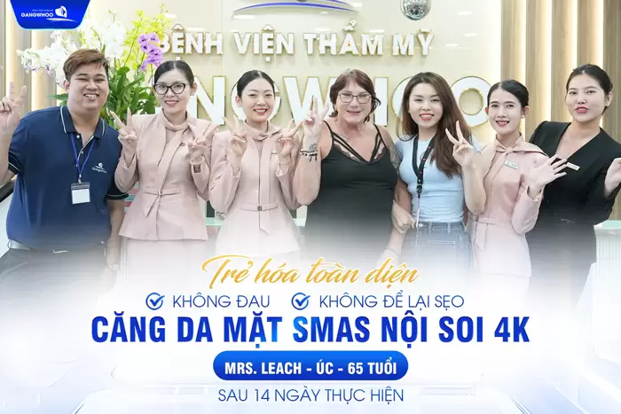 Phẫu Thuật Midface "Hack Tuổi" Tầng Mặt Giữa Xu Hướng Làm Đẹp Mới 13 Phẫu Thuật Midface "Hack Tuổi" Tầng Mặt Giữa Xu Hướng Làm Đẹp Mới