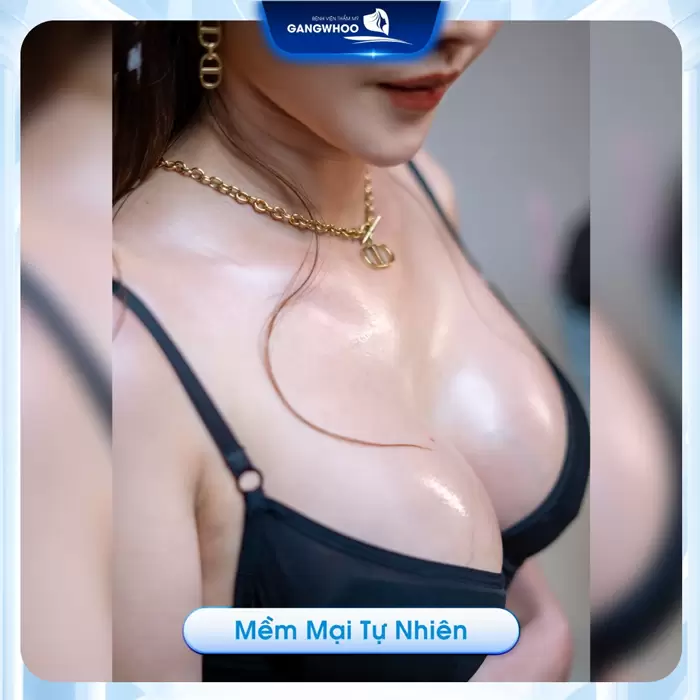 Đăng Ký Ngay! Nâng Ngực Nội Soi Miễn Phí 100% Từ Gangwhoo 7 nguc dep mem mai tu nhien