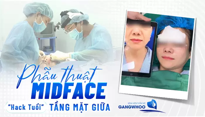 Phẫu Thuật Midface "Hack Tuổi" Tầng Mặt Giữa Xu Hướng Làm Đẹp Mới 8 Phẫu Thuật Midface "Hack Tuổi" Tầng Mặt Giữa Xu Hướng Làm Đẹp Mới