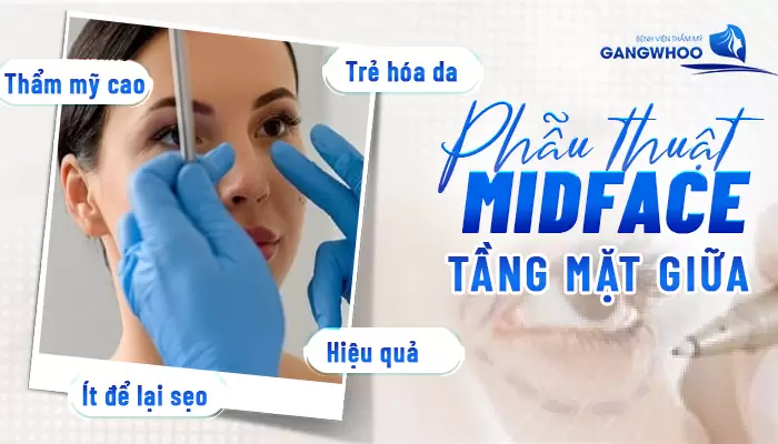 Phẫu Thuật Midface "Hack Tuổi" Tầng Mặt Giữa Xu Hướng Làm Đẹp Mới 10 Phẫu Thuật Midface "Hack Tuổi" Tầng Mặt Giữa Xu Hướng Làm Đẹp Mới