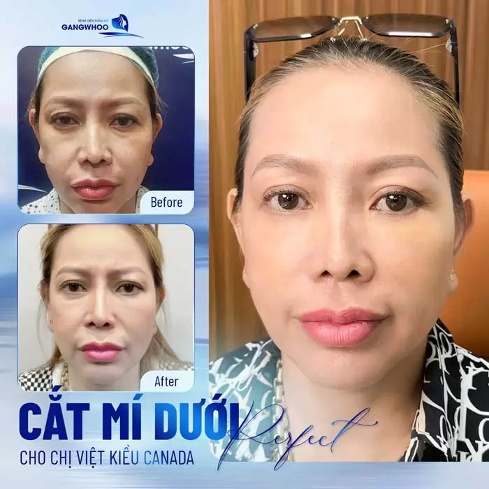 dich vu cat mi 30