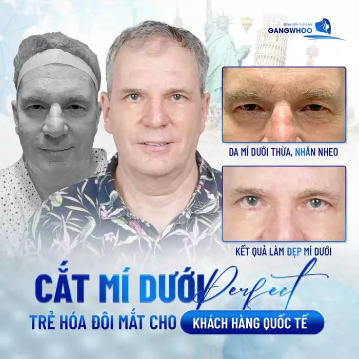 mat mi duoi 9