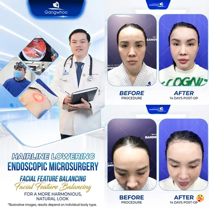 en ha duong chan toc 3