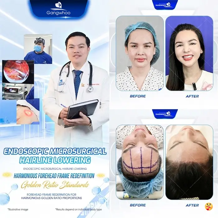 en ha duong chan toc 4