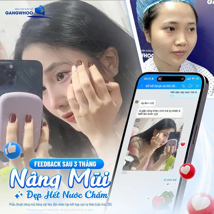 fb khach hang chia se sau phatu thuat nang mui nhe nhang va an toan