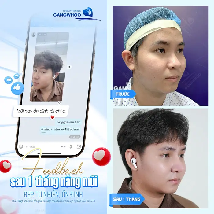 fb sau 1 thang nang mui dep tu nhien va on dinh