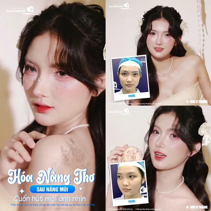 Hóa nàng thơ xinh đẹp sau nâng mũi tự tin khoe diện mạo cuốn hút ánh nhìn 
