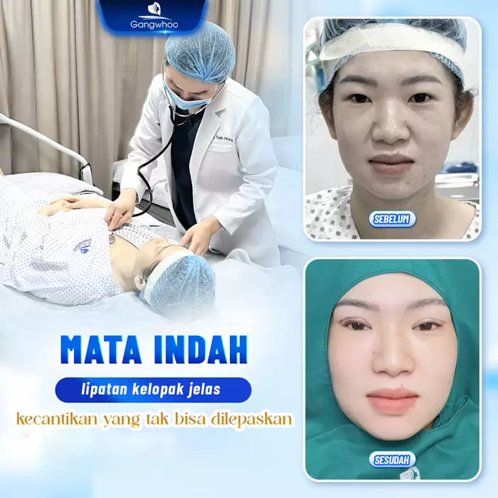 in bam mi han quoc 1