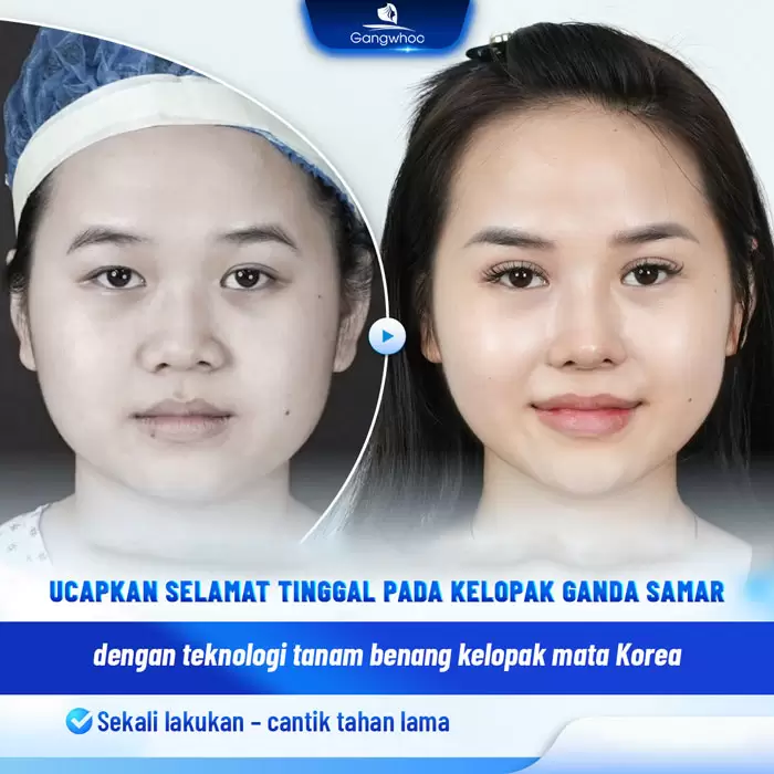 in bam mi han quoc 3