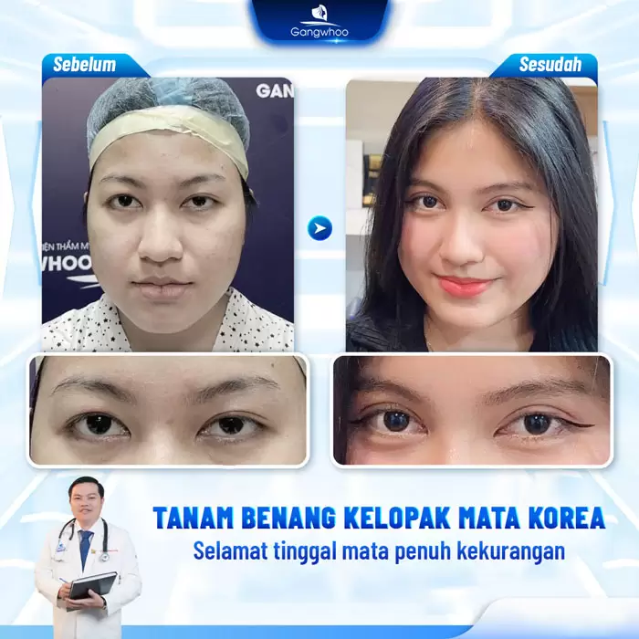 in bam mi han quoc 7