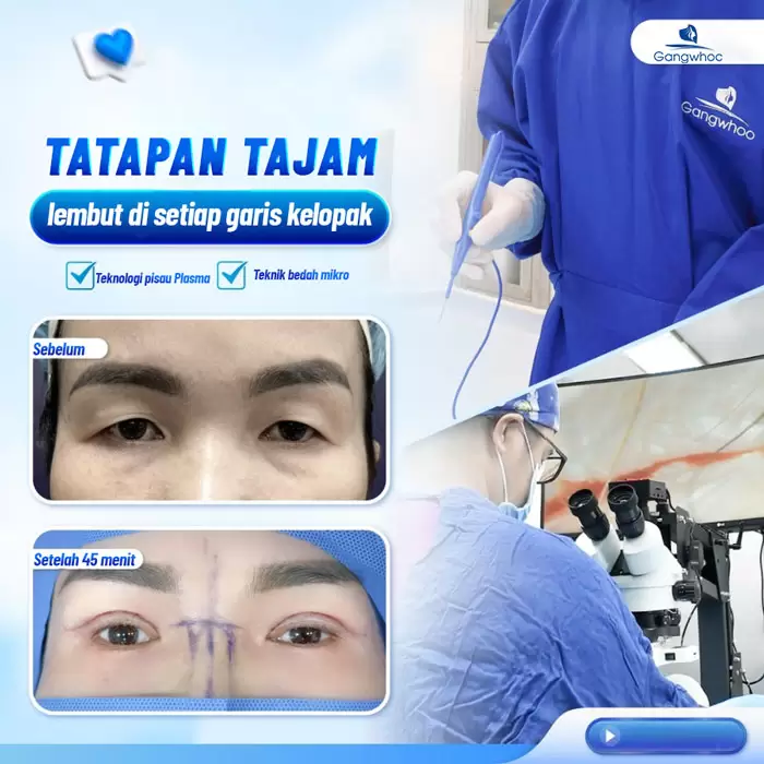 in cat mi 4 in 1 6