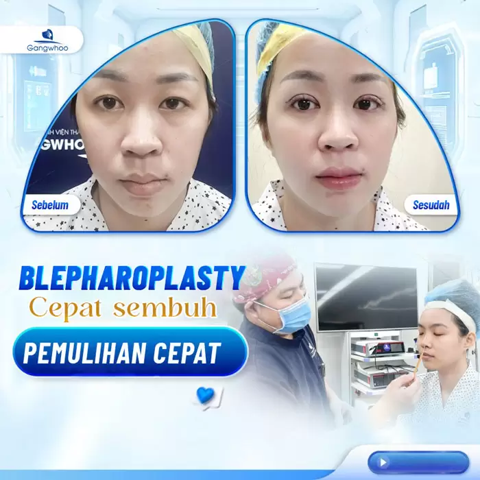 in cat mi 4 in 1 7