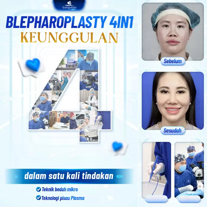 in cat mi 4 in 1 9