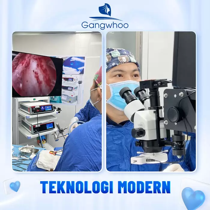 in lay mo mat noi soi 5