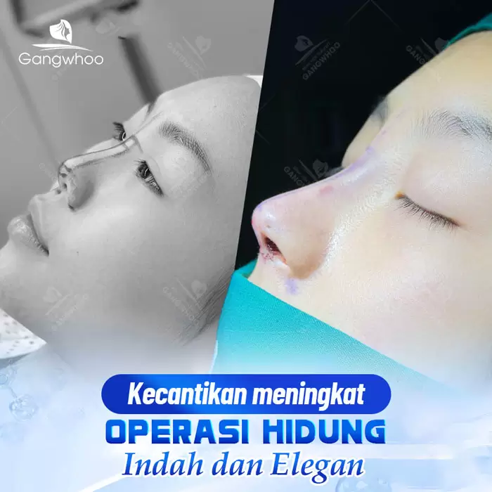 in nang mui bang chi 10