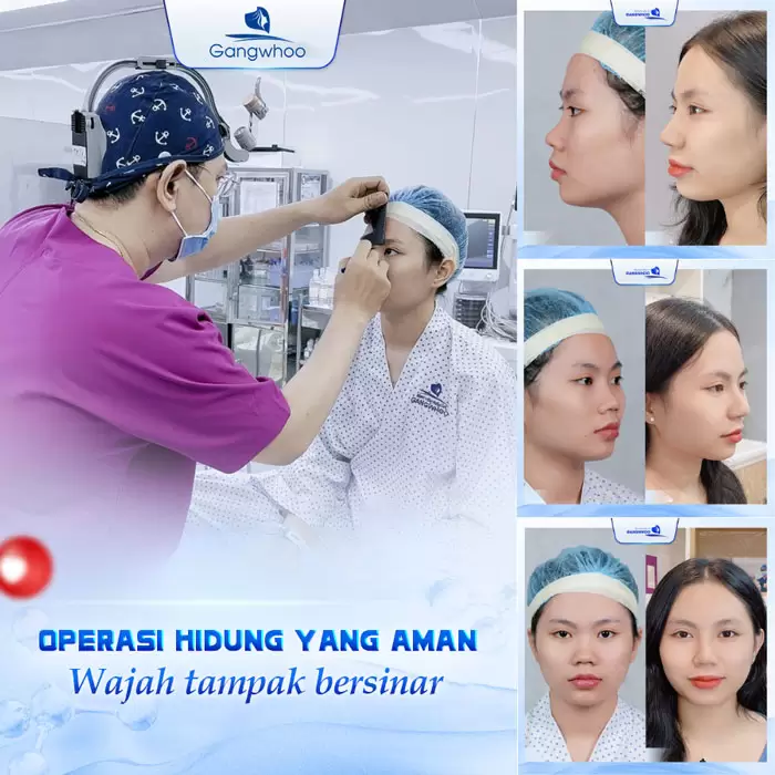 in nang mui bang chi 5