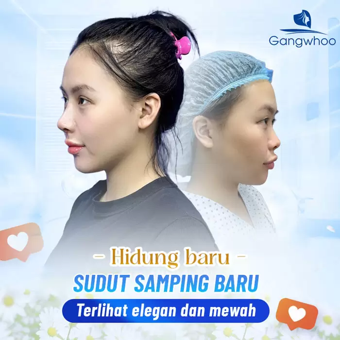 in nang mui sun suon 9