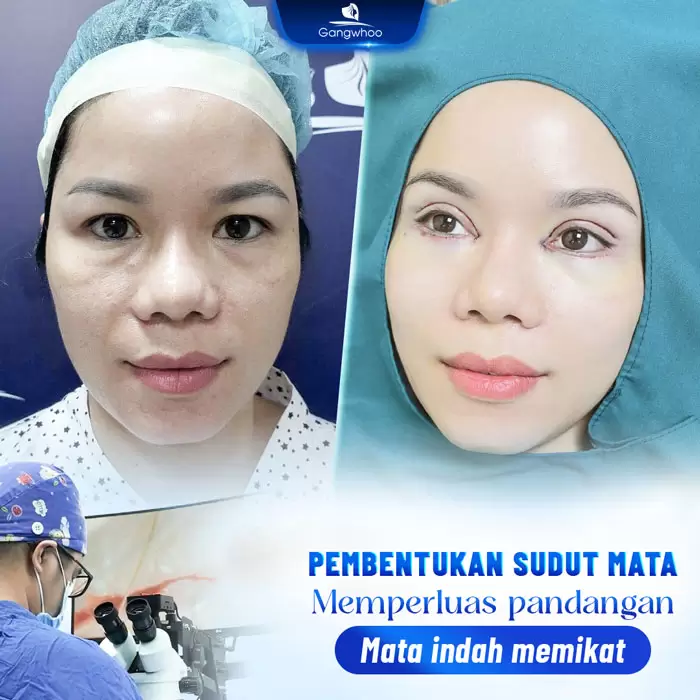 in tao hinh goc mat 2