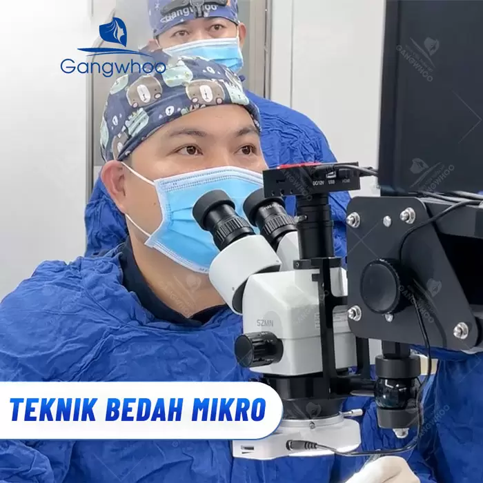 in tao hinh goc mat 3