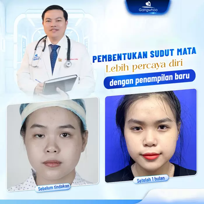 in tao hinh goc mat 4