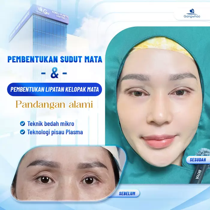 in tao hinh goc mat 6