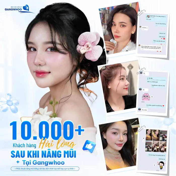 Hàng ngàn khách hàng hài lòng sau nâng mũi tại Gangwhoo