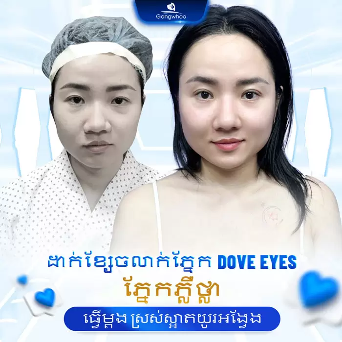 km bam mi dove eyes 10