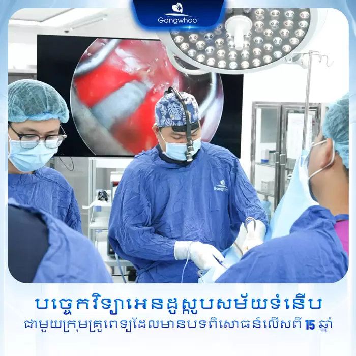 km bam mi dove eyes 2