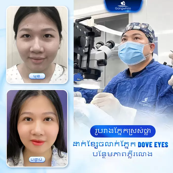 km bam mi dove eyes 5