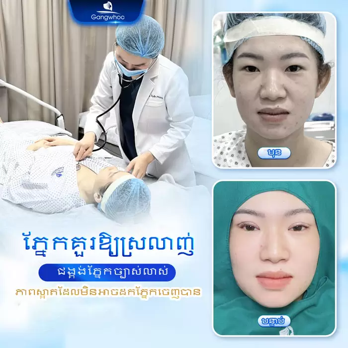 km bam mi han quoc 1