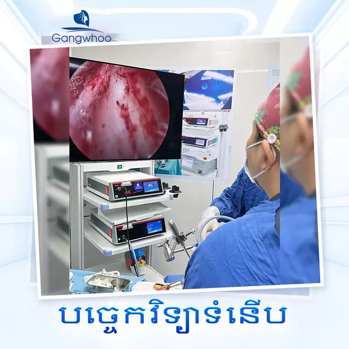 km bam mi han quoc 10