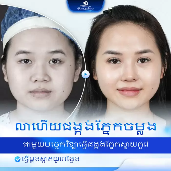 km bam mi han quoc 3