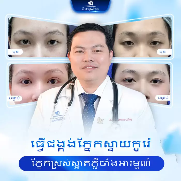 km bam mi han quoc 6