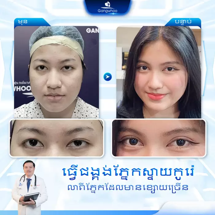 km bam mi han quoc 7