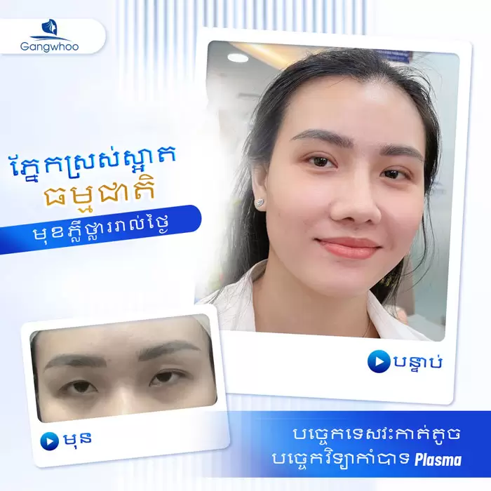 km bam mi han quoc 8