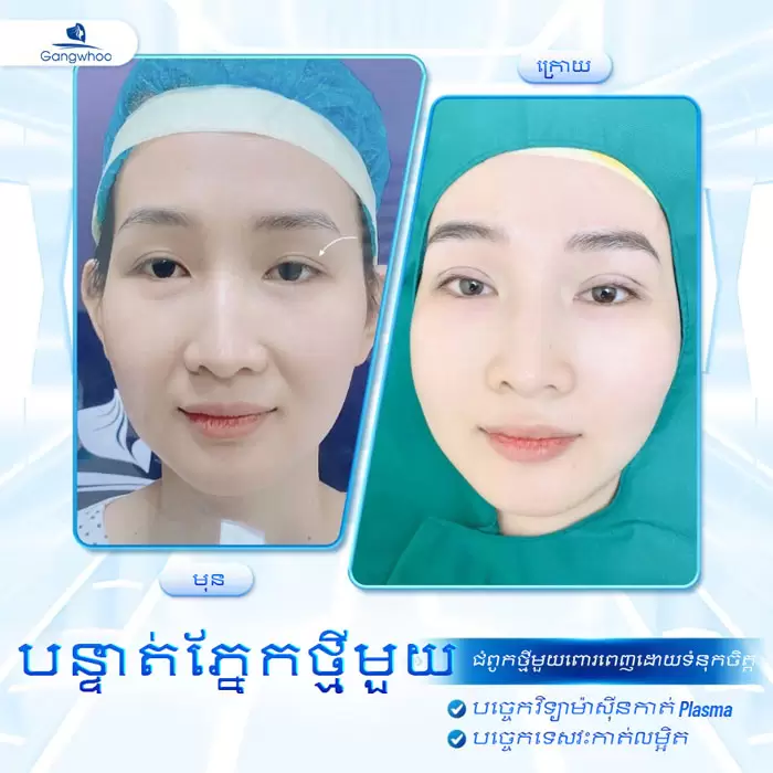 km cat mi han quoc 1