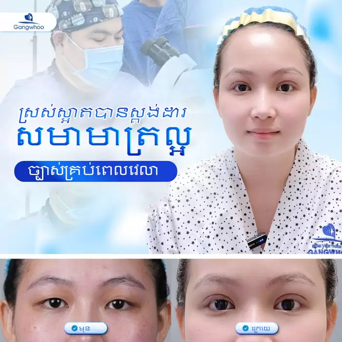 km cat mi han quoc 2