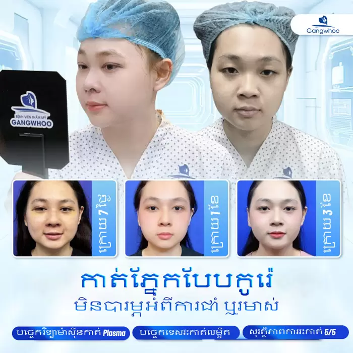 km cat mi han quoc 3