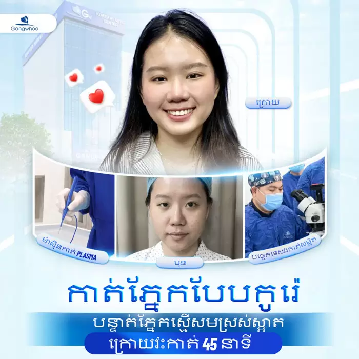 km cat mi han quoc 4